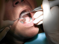 5 tysięcy na dentystę. Mamy nowy program dofinansowania leczenia stomatologicznego