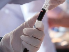 Oferta pracy: diagnosta laboratoryjny w Rzeszowie