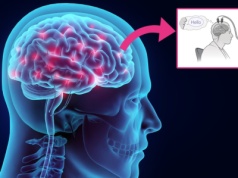 Czytanie w myślach jest możliwe? Powstał niezwykły implant mózgowy