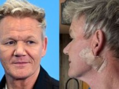 Gordon Ramsay ujawnił, że miał raka skóry. Żartował: 