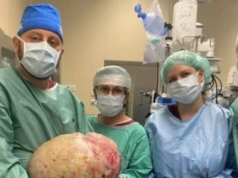 Niezwykła operacja w Elblągu: lekarze usunęli olbrzymi guz jajnika ważący 20 kg