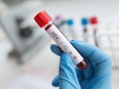 Co z leczeniem HIV dla nieubezpieczonych? NFZ: bez wskazania źródła finansowania to zadanie niemożliwe do realizacji