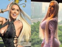 Chciała mieć pośladki jak Kim Kardashian. Dziś ostrzega inne kobiety. 