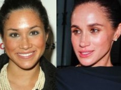 Ekspertka ruga Meghan Markle za zmiany w wyglądzie. W tle ZABIEGI, którym miała się poddać
