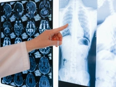 Rokowania gorsze niż w raku. Mniej niż co czwarta osoba zna prawidłową diagnozę