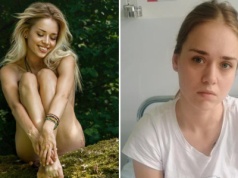 „Moje ciało nie współpracuje”. Fotomodelka z Olsztyna cudem uniknęła śmierci. Angelika Kaza walczy o każdy krok i apeluje o pomoc