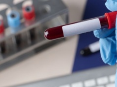 Badanie krwi zdradza stwardnienie rozsiane nawet 7 lat przed pierwszymi objawami