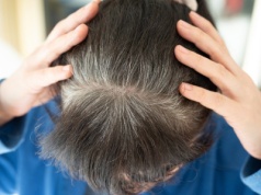 Zrób ten napar i zapomnij o siwieniu włosów. Wystarczy jeden produkt z kuchni