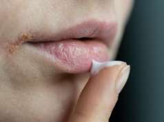 Wymieszaj w miseczce i nałóż grubą warstwę. Zapomnisz co to spierzchnięte usta