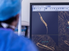 Dyrektor generalna GE HealthCare Poland: najnowsze urządzenia diagnostyki kardiologicznej przynoszą wiele innowacji