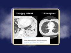 Tradycyjne papierosy kontra e-papierosy – czy można mówić o zdrowszej alternatywie?