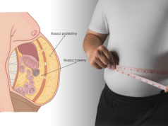 Kwestia kształtu? Zrozumienie i przeciwdziałanie insulinooporności