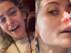 Córka Michaela Jacksona ma DZIURĘ W NOSIE przez narkotyki: "Zrujnowało mi to życie"