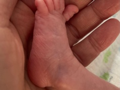 Światowy Dzień Wcześniaka: wsparcie dla najmłodszych i ich rodzin