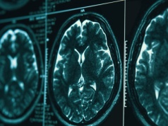 Naukowiec od lat bada inteligencję. Mówi, co bezpowrotnie zmienia nasz mózg