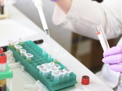 Ceny badań w górę. Wiadomo, o ile podrożeją