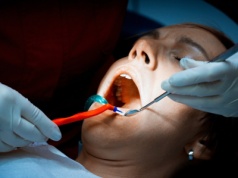 Potrzebny pilny zakaz w sprawie plomb. Jest apel w tej sprawie