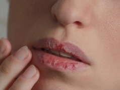 Tak wyglądają usta, gdy organizm ma się źle. Sprawdź, czy masz te objawy
