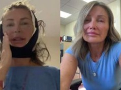 Zafundowała sobie lifting w Turcji. Dziś tiktokerka wygląda o 20 lat młodziej. Zgadniecie, ile ma lat?