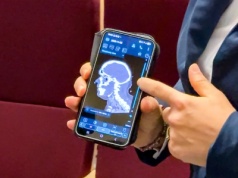 Rewolucja w leczeniu udarów na Dolnym Śląsku