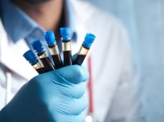 MZ ogłosiło limity i finansowanie miejsc szkoleniowych dla medycyny laboratoryjnej na 2026 r.