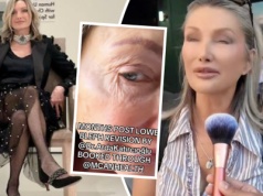 TikTokerka poleciała na operacje plastyczne do Turcji. "Rzeźnicy! Wyglądam gorzej niż przed operacją"