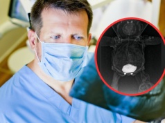 Pokazał RTG pluszowego misia swojej córki. 