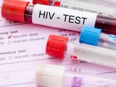Światowy Dzień AIDS. System wpływa w Polsce na wykrywalność zakażeń w pewnej grupie wiekowej?