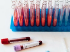 Światowy Dzień AIDS: eksperci alarmują. Polska pilnie potrzebuje zmian systemowych