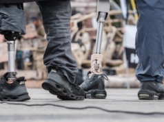 Niemieckie firmy zwiększają dostawy do Rosji. Chodzi o… protezy