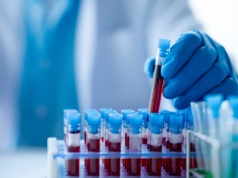 Badanie ujawniło unikalny typ krwi. Występuje tylko u trzech osób na świecie