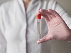 Wykrywa raka w bardzo wczesnym stadium. To nadzieja dla wielu pacjentów