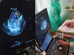 Najnowocześniejszy ultrasonograf dla najmniejszych pacjentów dzięki wsparciu Fundacji PGE