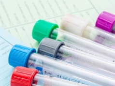 Podwyższony poziom może kryć pasożyty, alergię i choroby krwi. Sprawdź