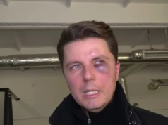 Były partner znanej prezenterki pobity przez aktywistę. Polała się krew