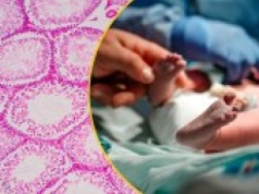 Genetyczna pułapka w banku spermy. Blisko 200 dzieci w Europie zagrożone rakiem