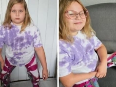 9-letnia Amelka z Borków Paduchów walczy o sprawność. Urodziła się bez kości piszczelowych – potrzebna pilna operacja za 100 tys. zł