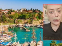 Poszła do dentysty w Turcji. Szok, co stało się potem z jej twarzą