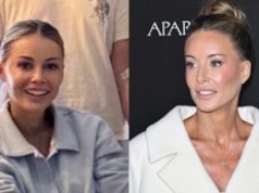 Podejrzanie gładka Małgorzata Rozenek-Majdan uśmiecha się na Instagramie. Zaszalała z retuszem? (FOTO)