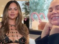 Świąteczny DRAMAT Chrissy Teigen: STRACIŁA ZĘBA! Poległ w starciu ze świątecznym cukierkiem... (FOTO)