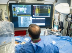 Rewolucja w kardiologii na Teneryfie: ablacja bez skalpela