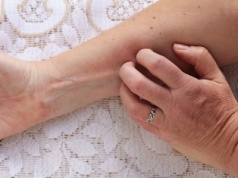 Zapomnij o suchej i szorstkiej skórze zimą. Tak przywrócisz jej gładkość