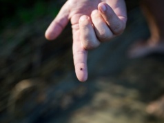 Czym jest borelioza?