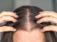 Martwi cię wypadanie włosów? Tych przyczyn nie możesz ignorować, jeśli chcesz mieć gęstą czuprynę