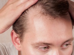 Dutasteryd — nowy surowiec w recepturze