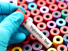 Szczupłość nie chroni przed zaburzeniami lipidowymi. Te czynniki mają wpływ