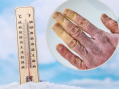 Nie trzeba siarczystych mrozów, by nabawić się odmrożeń. Na początku nawet ich nie czuć