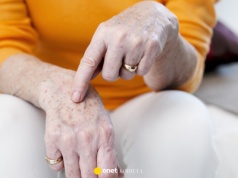 Kosztuje 8 zł, a usuwa plamki starcze z dłoni jak laser. Odmładza i łagodzi podrażnienia