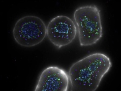 Odkryli sposób na "superdoładowanie" układu odpornościowego do walki z rakiem