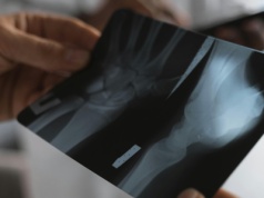 Ponad 40 tys. zł za wizytę na SOR. W tym kraju bez odpowiedniej polisy lepiej nie chorować